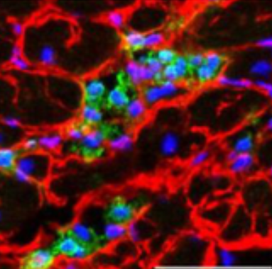 Inflammaging Therapeutics